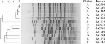 Molecular Mechanism of the β-Lactamase Mediated β-Lactam Antibiotic Resistance of Pseudomonas aeruginosa Isolated From a Chinese Teaching Hospital